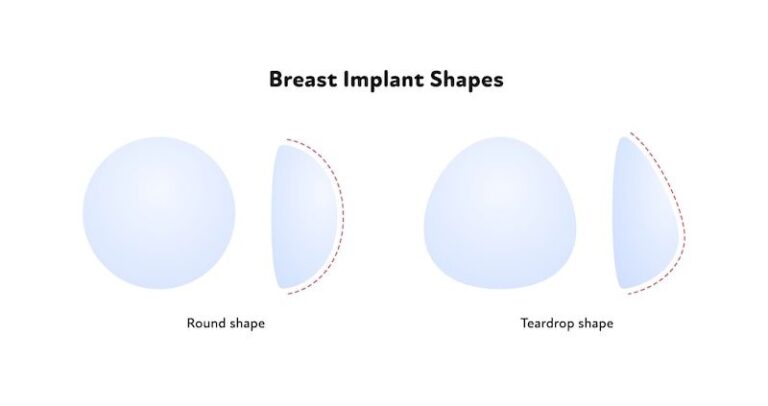 Want Breast Augmentation Your In Depth Guide To Understanding Breast