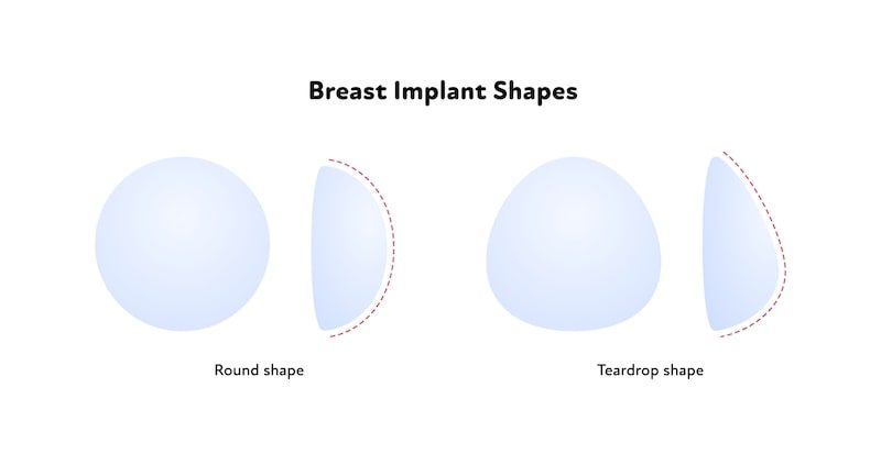Different Types of Breast Implants - Round vs Tear Drop Implants